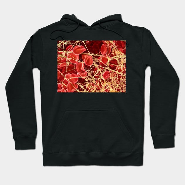 Blood clot, SEM (P260/0107) Hoodie by SciencePhoto